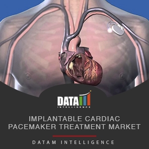 Implantable Cardiac Pacemaker Treatment Market, Size, Share, Outlook ...