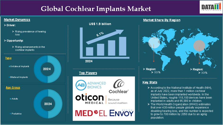 Cochlear Implants Market 2025