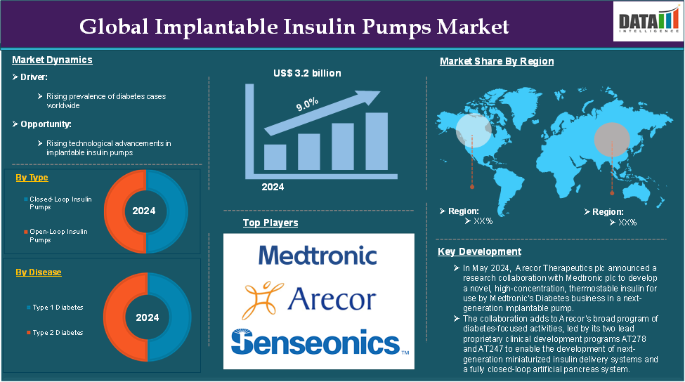 Implantable Insulin Pumps Market 2025