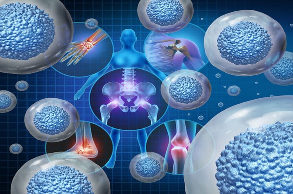 Applications of Stem Cell Therapy