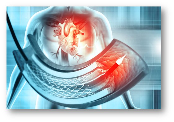 Interventional Cardiology Market
