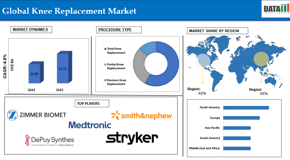 Knee Replacement Market 2025