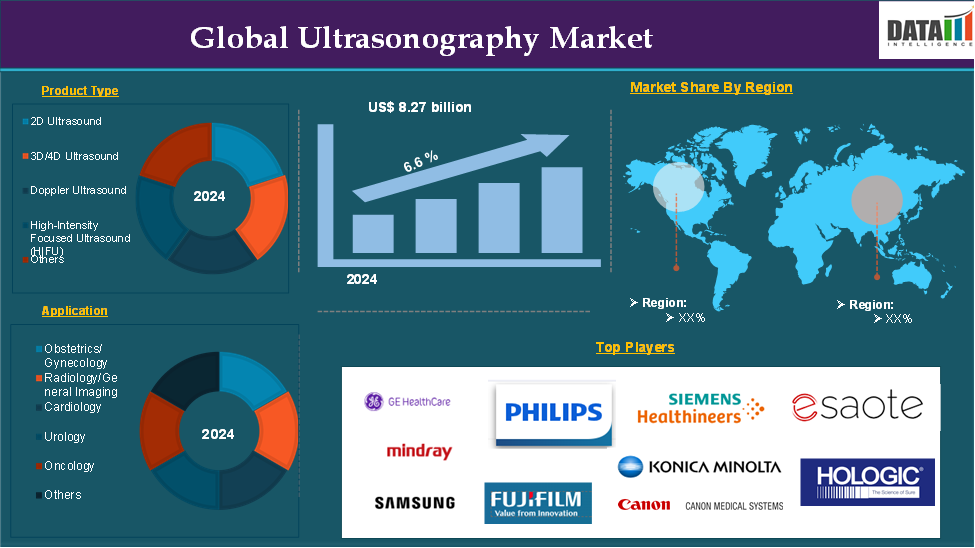 Ultrasonography Market 2025