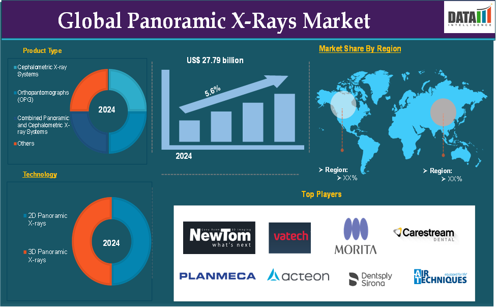 Panoramic X-Rays Market 2025