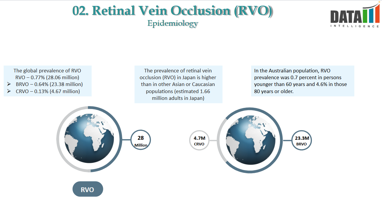 Retinal Vein Occlusion (RVO) - Epidemiology Image