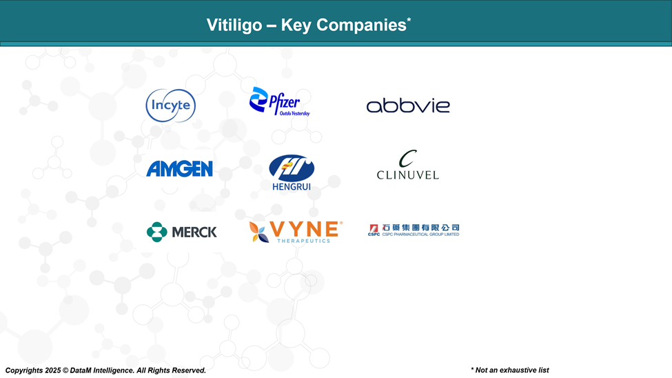 Vitiligo - Key Companies