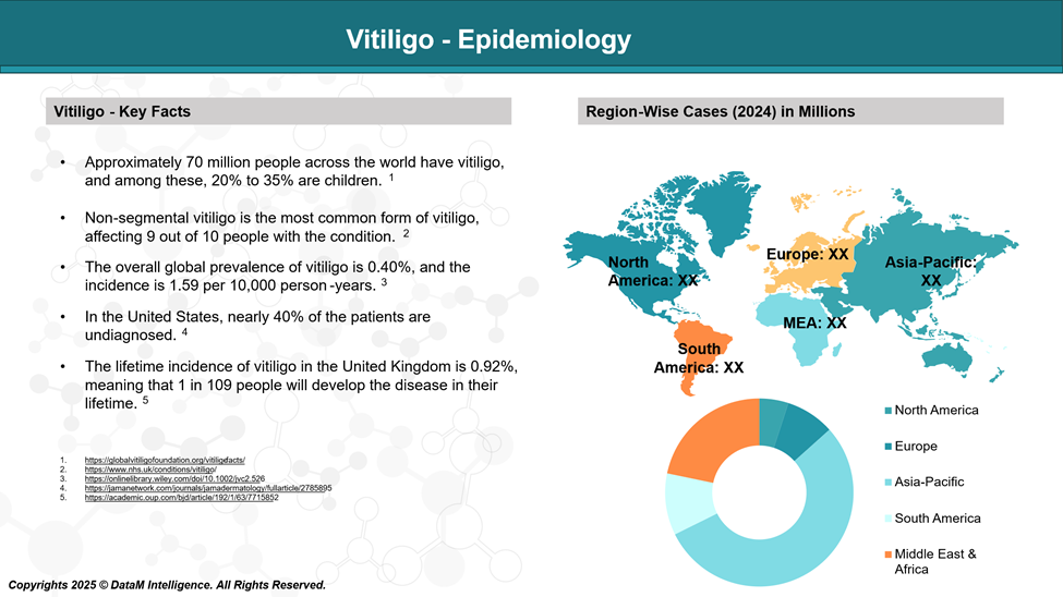 Vitiligo - Epidemiology