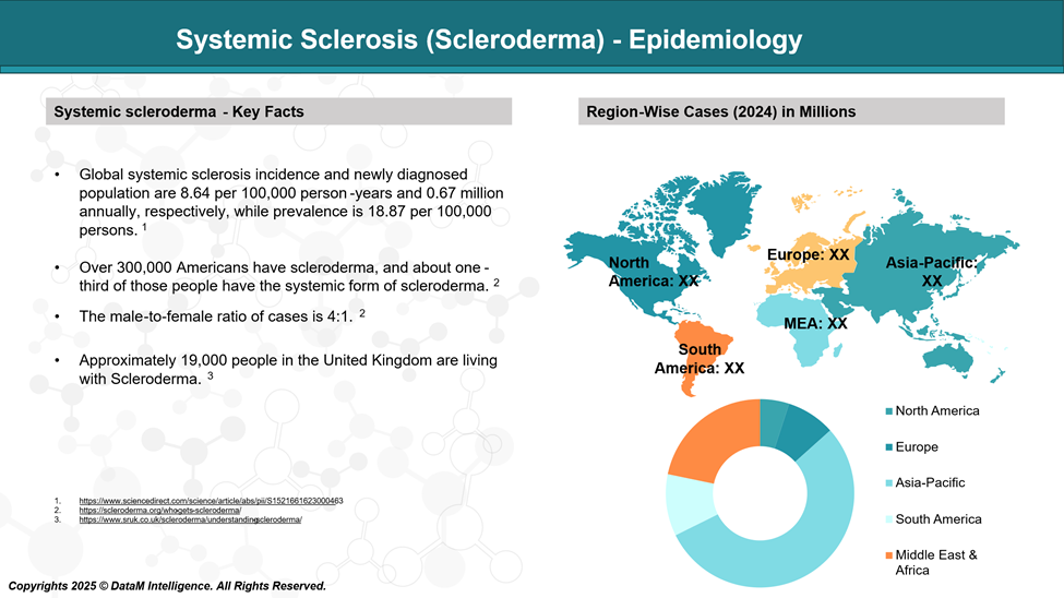 Systemic sclerosis (SSc) - Epidemiology