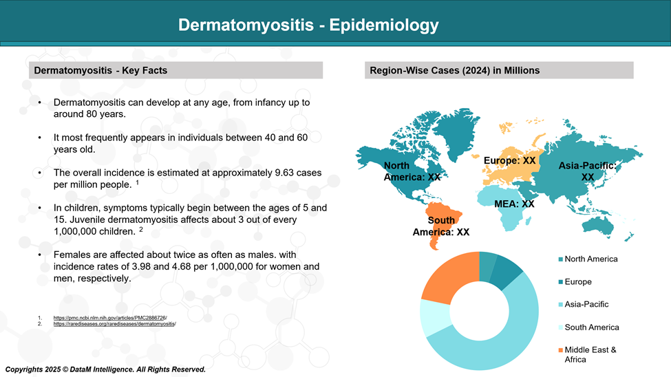 Dermatomyositis - Epidemiology