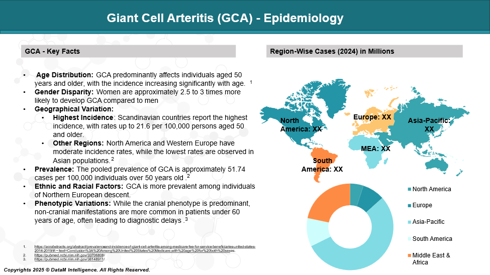 Giant Cell Arteritis (GCA) - Epidemiology 