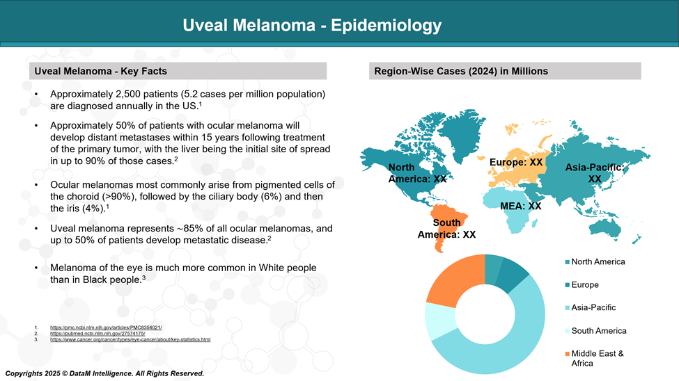 Uveal Melanoma - Epidemiology