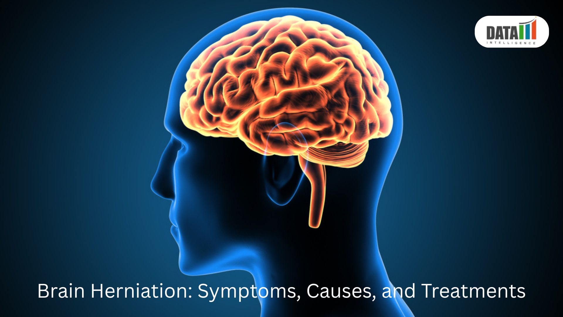 Brain Herniation Symptoms, Causes, and Treatments