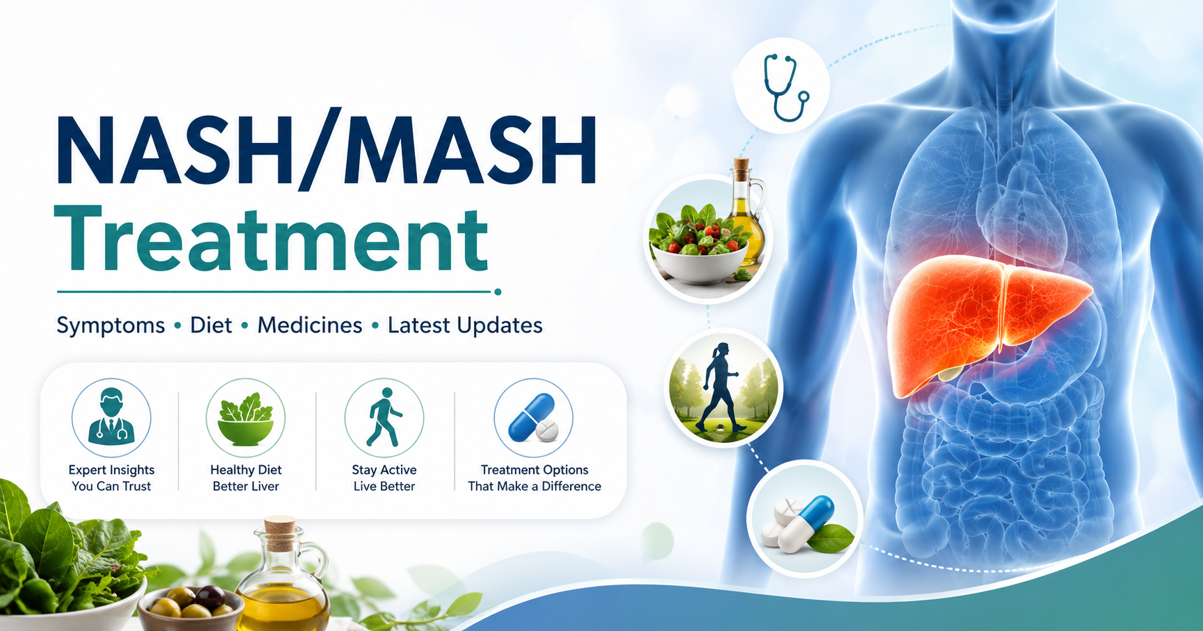 Thumbnail for NASH/MASH Treatment: Symptoms, Causes, Diet, Medicines and What’s New